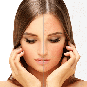 Esteticlassonline - skincare_ilanalopes