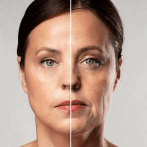 Esteticlassonline - skincare_ilanalopes