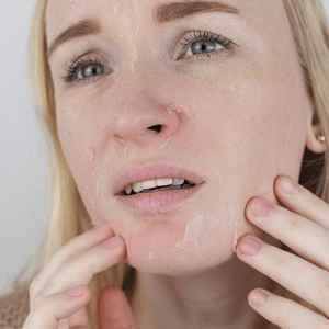 Esteticlassonline - skincare_ilanalopes