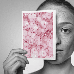 Esteticlassonline - skincare_ilanalopes